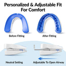 Anti Snoring Mouth Guard Improve Sleeping Adjustable Snoring Mouth Guard Anti-Apnea Teeth Bruxism Stop Snoring Device Mouthpiece