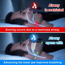 Anti Snoring Mouth Guard Improve Sleeping Adjustable Snoring Mouth Guard Anti-Apnea Teeth Bruxism Stop Snoring Device Mouthpiece